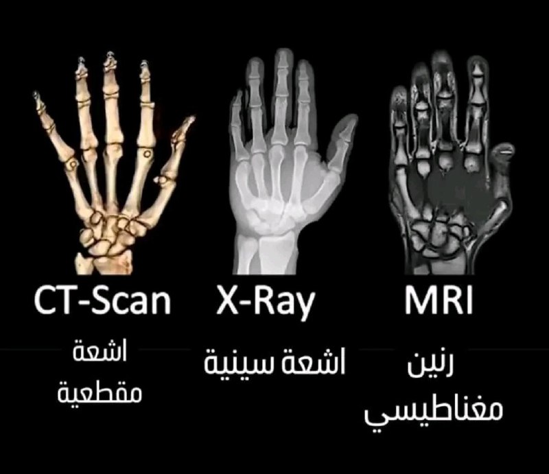 ***🔍*** ما الفرق بين الأشعة السينية …