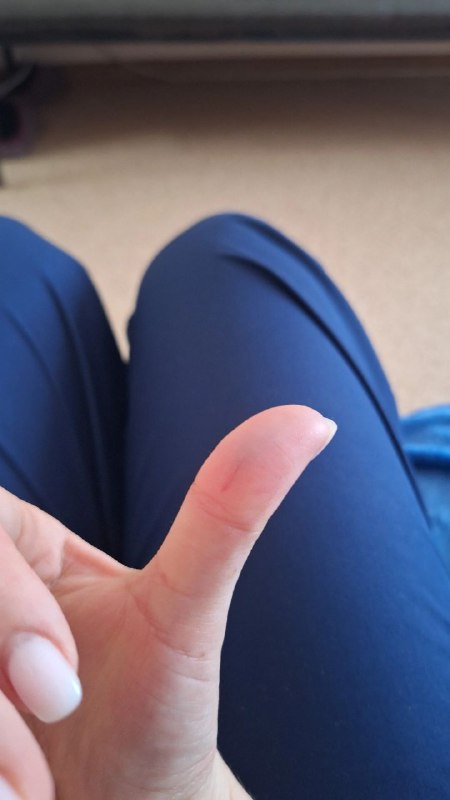 Первые жертвы сука :")