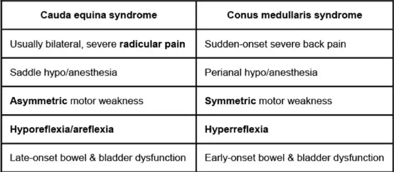 Cauda equina syndrome vs Conus medullaris …
