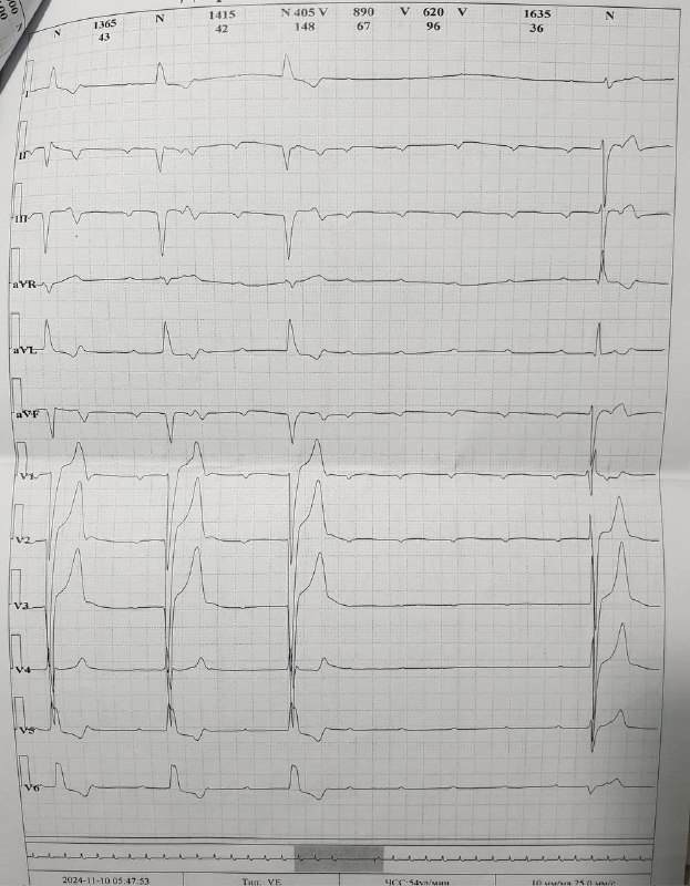 EKG DARSLARI