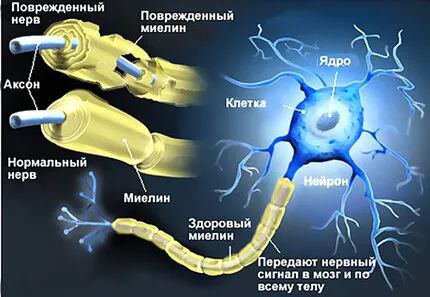 ***💚******💚******💚******💚******💚******💚*** **подобен*******💚**********💚**********💚**********💚**********💚**********💚**********💚**********💚***** **на электропроводах.**