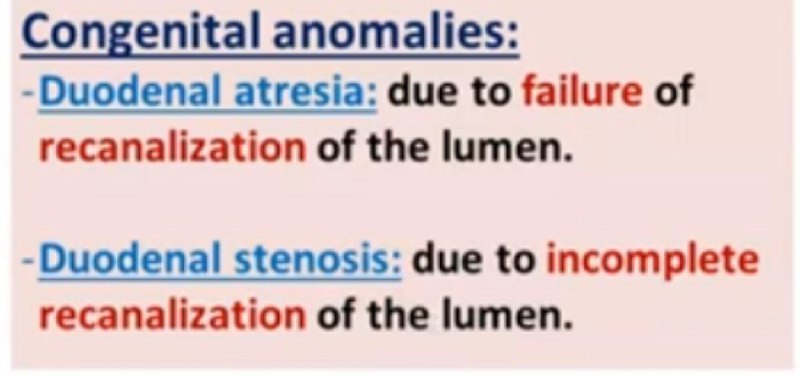 Congential anomalies of the duodenum