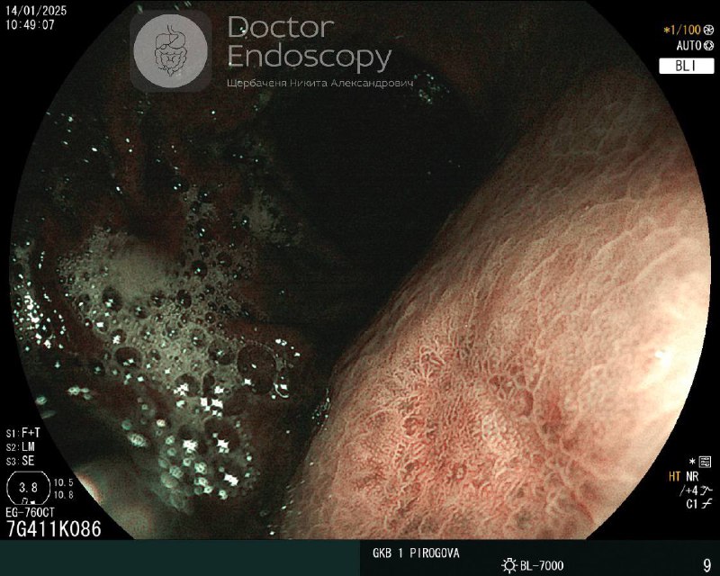 Doctor Endoscopy