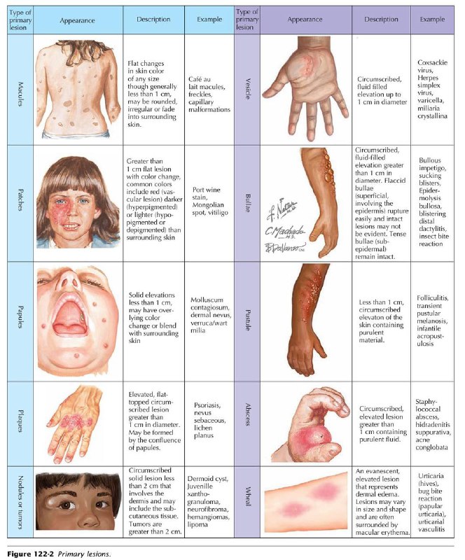 Primary Skin Lesions, Discerption and Examples