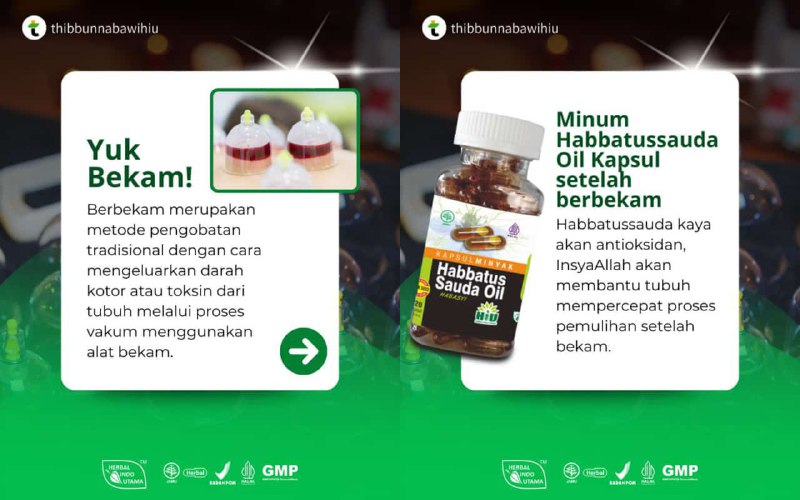 Jadikan bekam sebagai bagian dari gaya …