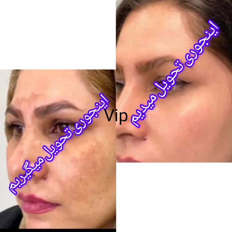**عکس بالارو ببین پوستش برق میزنه***?******?******?*****