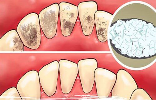 ***💠*** **Do this dental trick in …