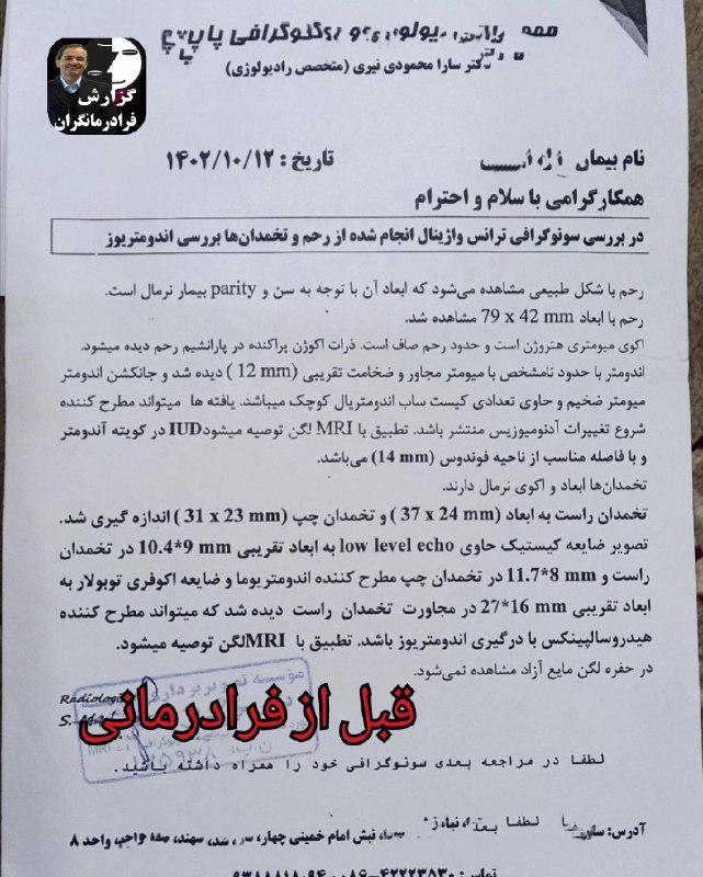 ۱۲۹۶***?*** گزارش درمان............نوع بیماری: [#آندومتریوز](?q=%23%D8%A2%D9%86%D8%AF%D9%88%D9%85%D8%AA%D8%B1%DB%8C%D9%88%D8%B2)