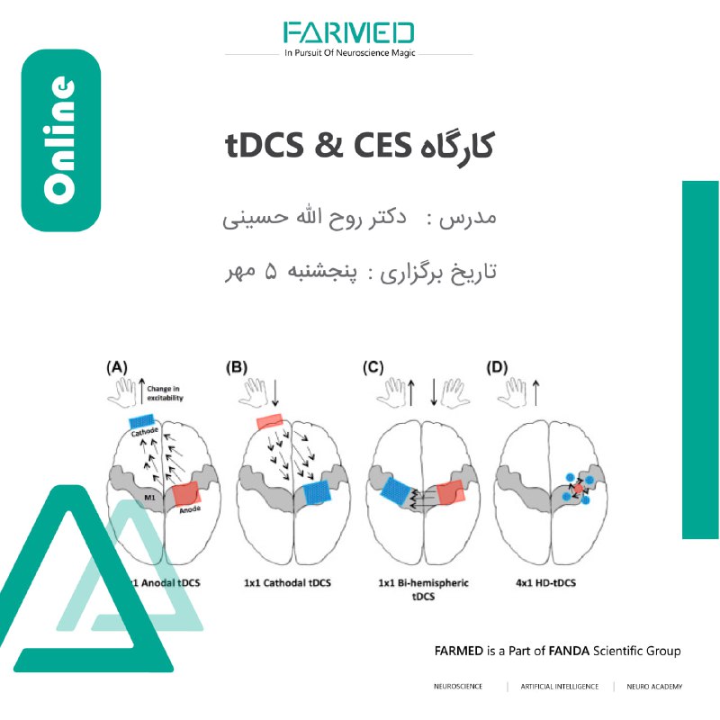 ***✅*** کارگاه تحریک الکتریکی مغز CES/tDCS-آنلاین