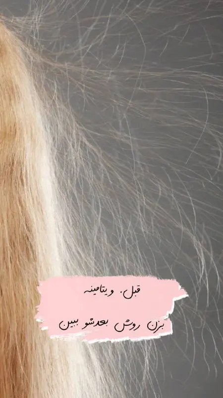فروش در استوری
