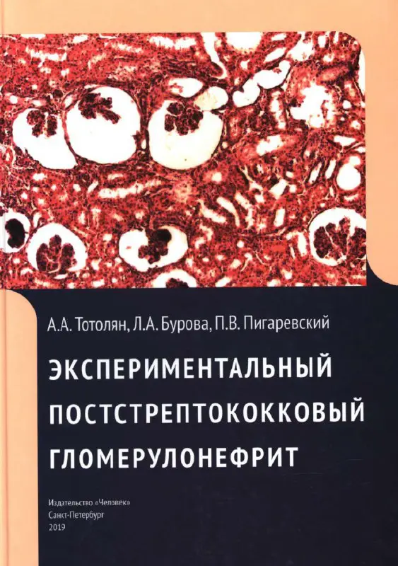 Экспериментальный постстрептококковый гломерулонефрит. А.А. Тотолян, Л.А. …