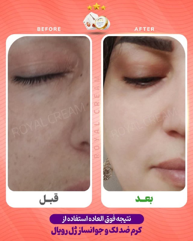 یه قبل و‌بعد خفن دیگه از …