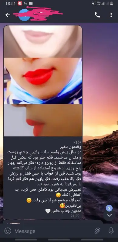 نتیجه از ساب سفارشی ***?******?***