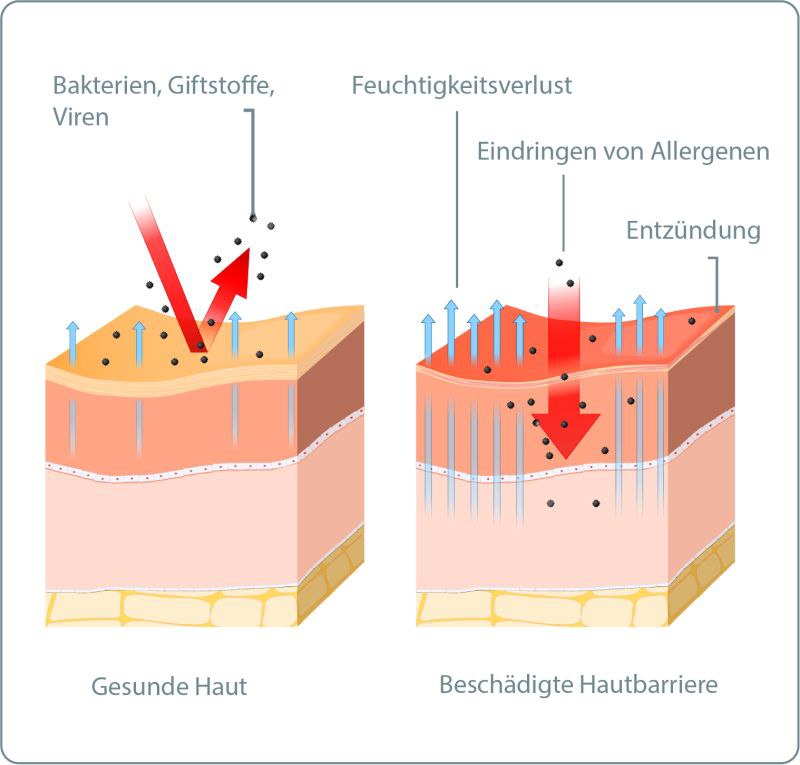 **Dermatosen**