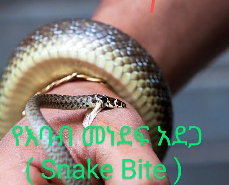 የእባብ መነደፍ አደጋ ( Snake Bite …