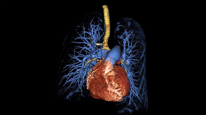 **SGLT2 Inhibitors Associated With Better Survival …