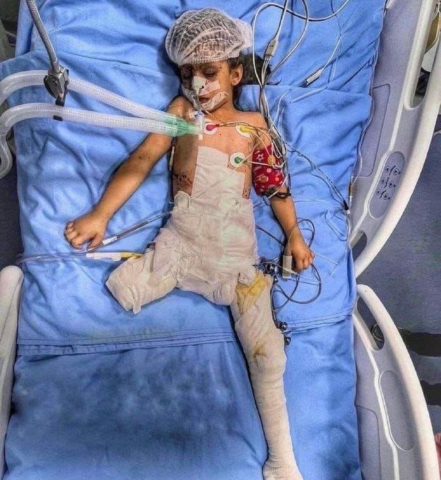 أين الحقوق وقد أُبيدتْ أمةٌ؟! وأنا …