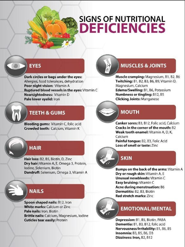 Signs of nutritional deficiencies in Eyes, …