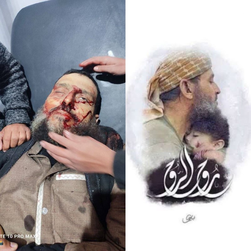 [#شـــام\_الحبیـــــــــــــــــــــــــــــــــــــــــــب](?q=%23%D8%B4%D9%80%D9%80%D9%80%D8%A7%D9%85_%D8%A7%D9%84%D8%AD%D8%A8%DB%8C%D9%80%D9%80%D9%80%D9%80%D9%80%D9%80%D9%80%D9%80%D9%80%D9%80%D9%80%D9%80%D9%80%D9%80%D9%80%D9%80%D9%80%D9%80%D9%80%D9%80%D9%80%D9%80%D9%80%D9%80%D9%80%D9%80%D9%80%D9%80%D9%80%D9%80%D9%80%D9%80%D9%80%D9%80%D9%80%D9%80%D9%80%D9%80%D9%80%D9%80%D9%80%D9%80%D9%80%D8%A8)