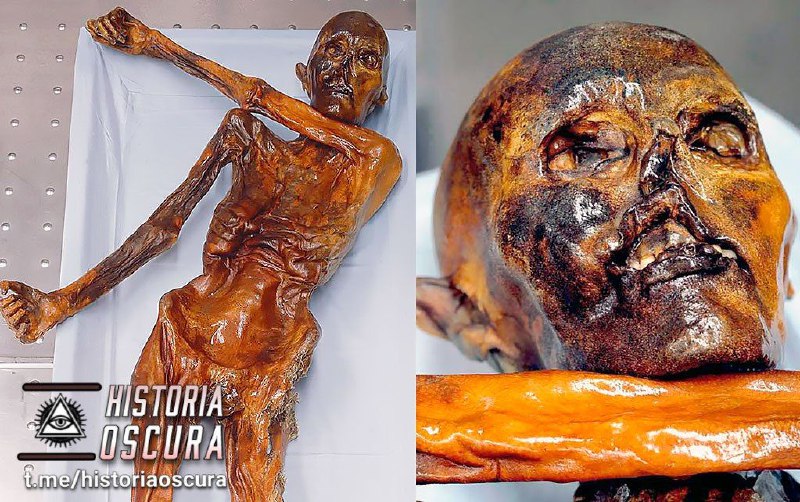 ***⚰*** La momia Ötzi.