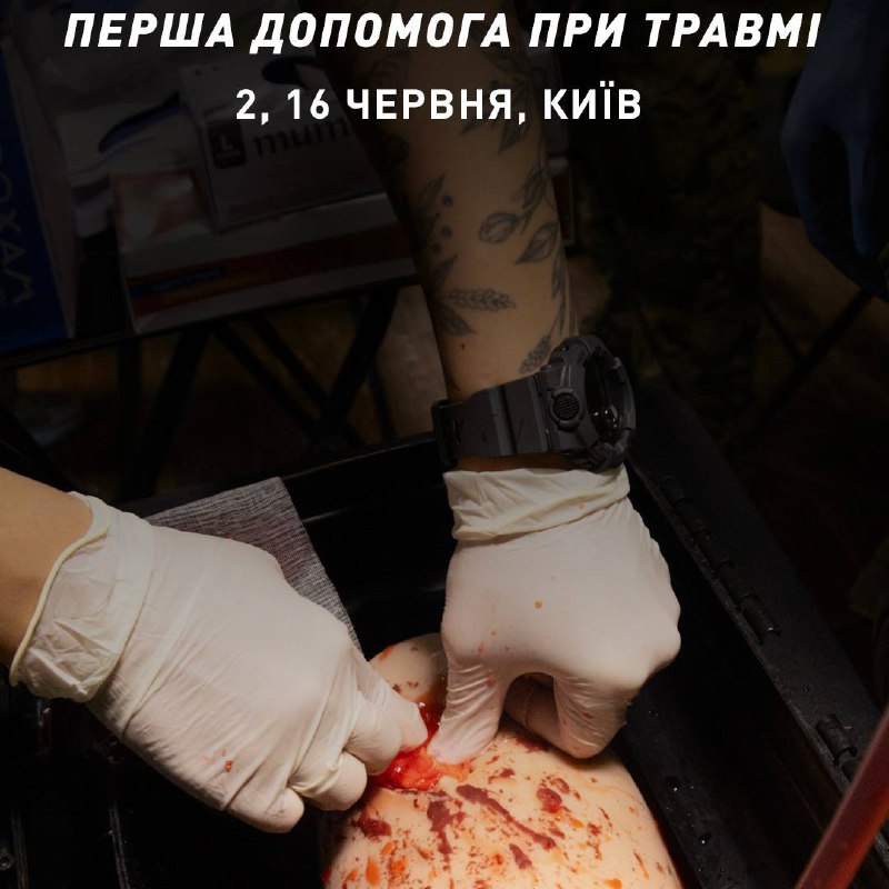 ***😎***перша допомога при травмі у Києві: