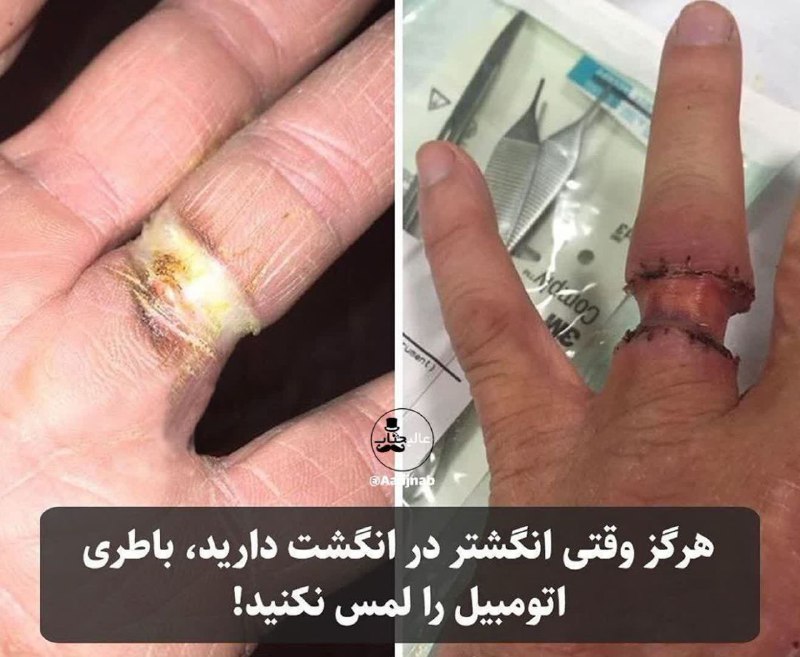 ***🔸***هشدار جدی/ هرگز وقتی انگشتر یا …