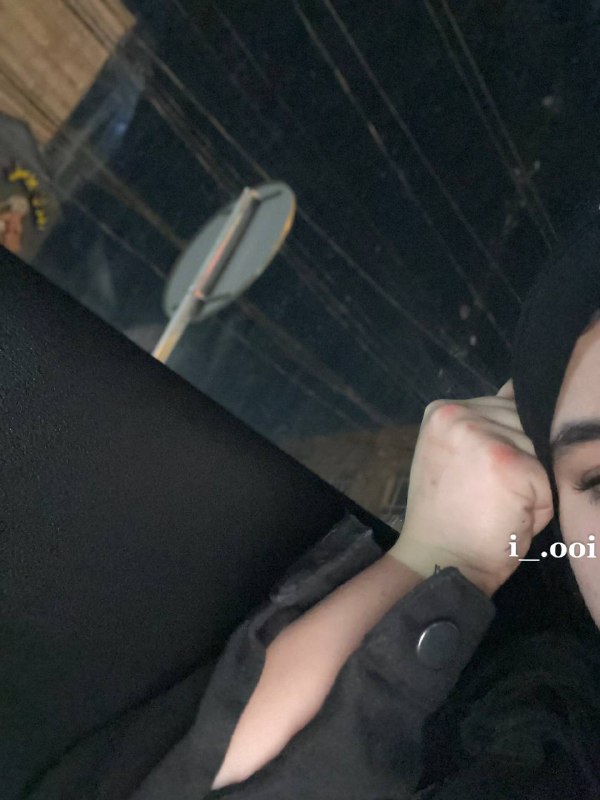 2:2