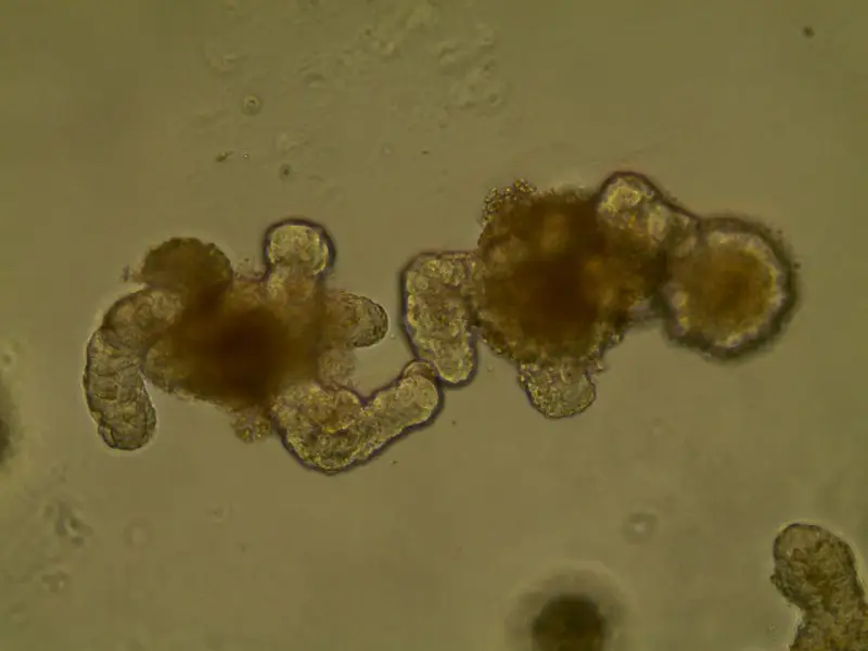 Two intestinal organoids holding hands ***🤝***