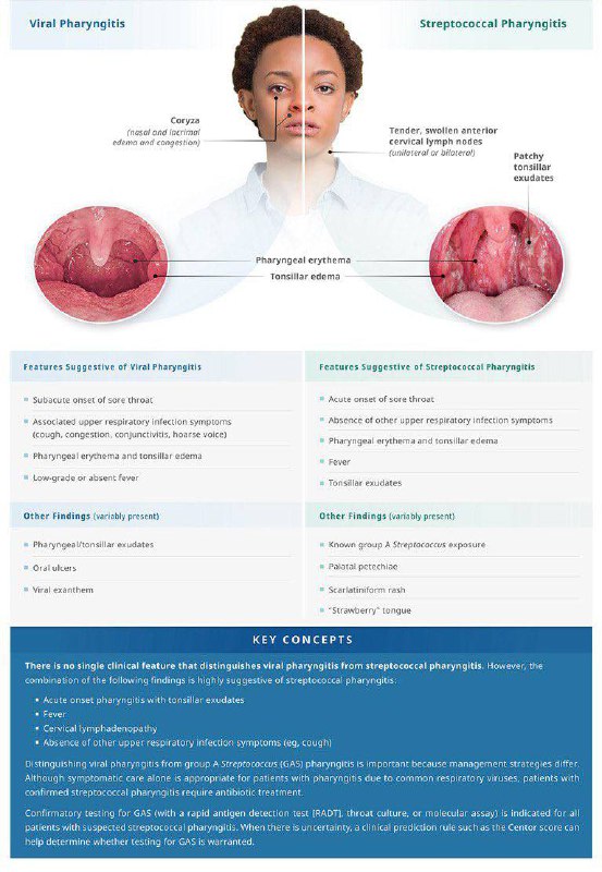 Distinguishing Viral Pharyngitis from Streptococcal Pharyngitis