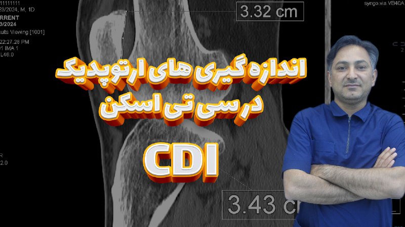 *****📌***** **تکنیک اندازه گیری CDI در …