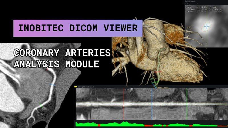 [Check out](https://www.youtube.com/watch?v=2P0gY-r_0oI) our additional module for …