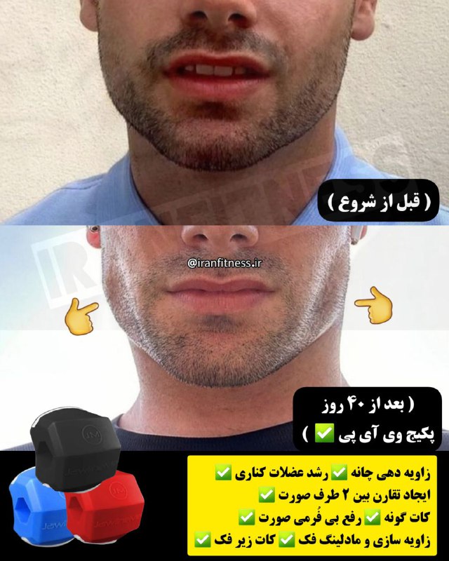 زاویه دهی فک با تمرین ( …