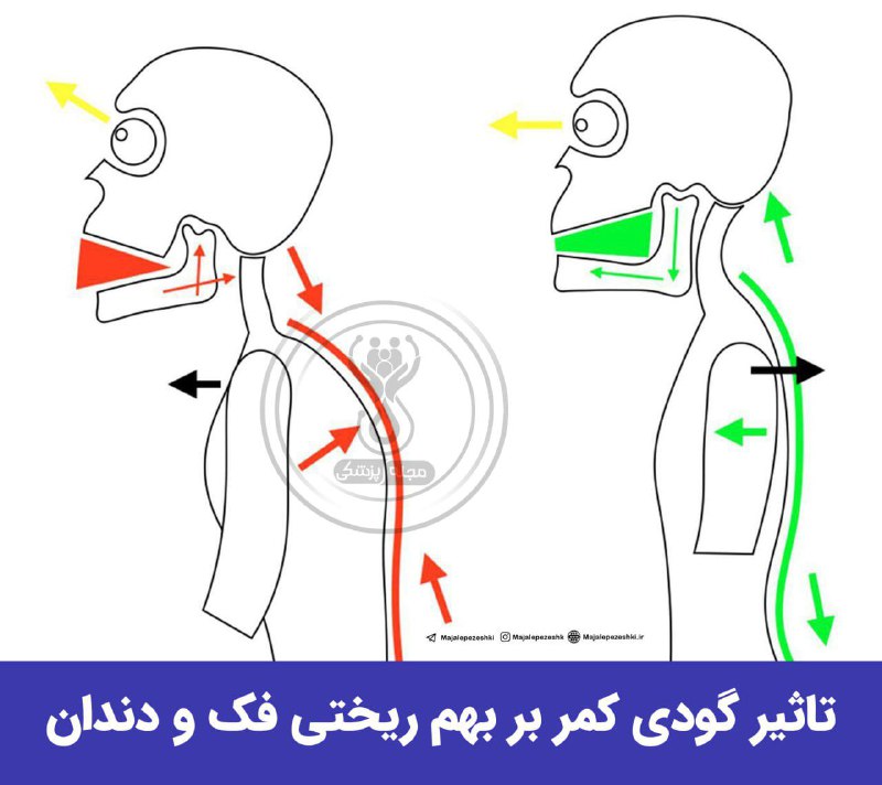***❓*****آیا گودی کمر بر روی فرم …