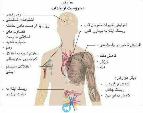 اگر به اندازه کافی استراحت نکنید، …