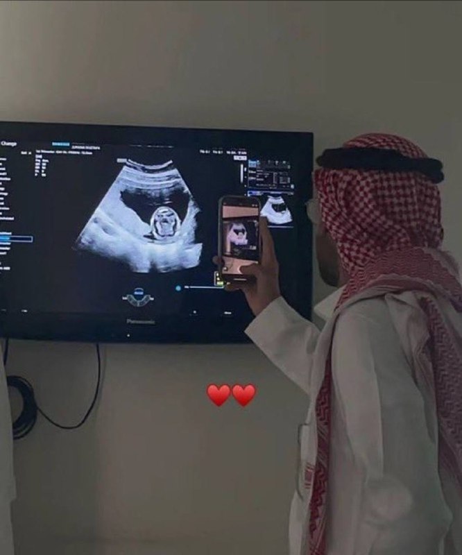 شَيء