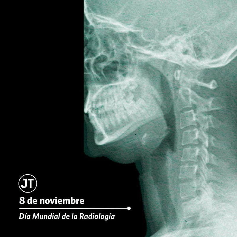 ***🩻*** Gracias a la radiología hoy …