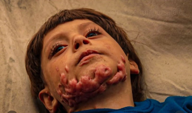هذا ما تخلفه الصواريخ **"الصهيونية"** في …