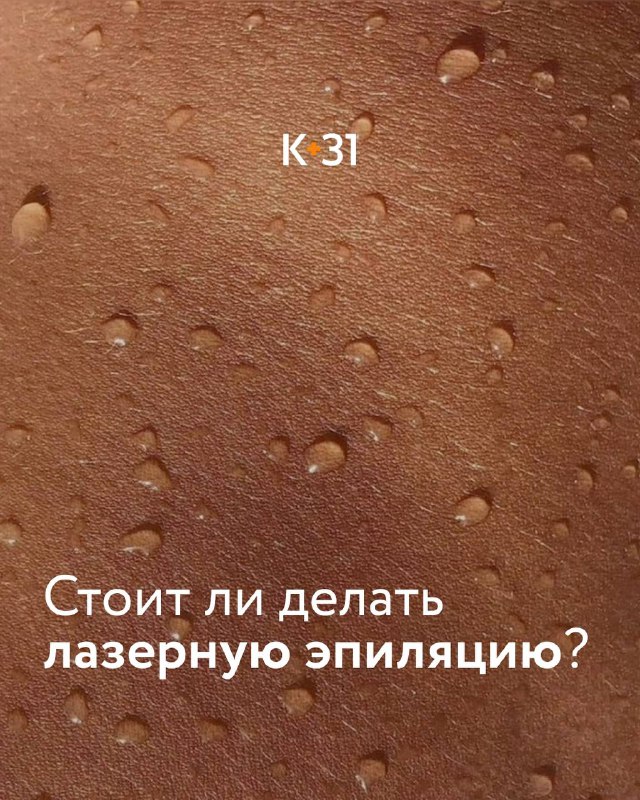 Стоит ли делать лазерную эпиляцию?