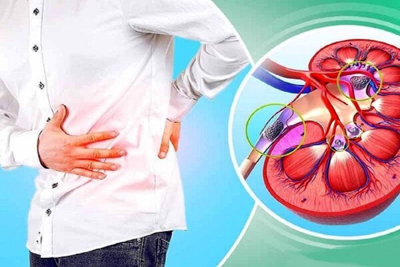 ***?*** *چرا تشخیص زودهنگام بیماری‌های کلیوی …
