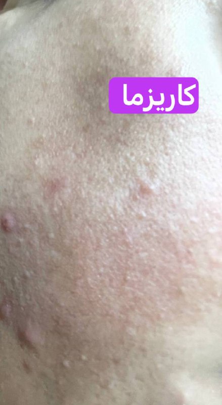 ګأّريِّزِّمَا