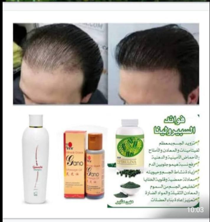 خلطات و العنايه للشعر