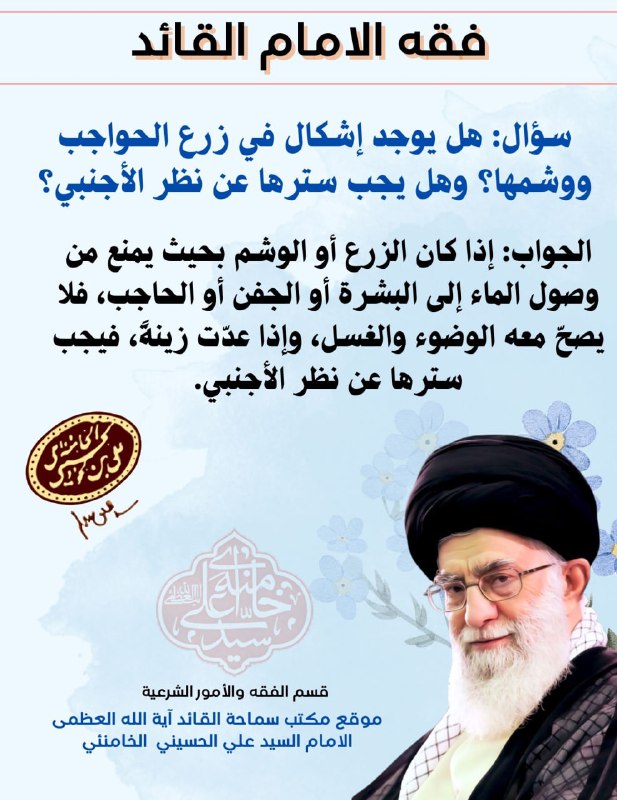 **سؤال: هل یوجد إشكال في زرع …