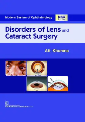 Disorders of Lens and Cataract Surgery …