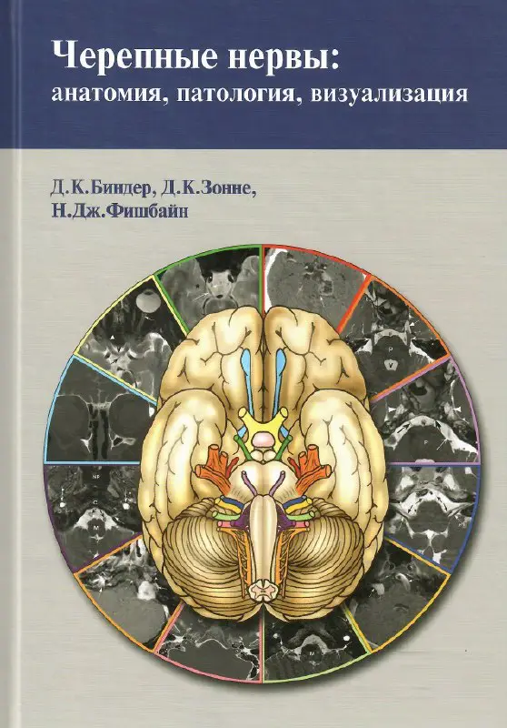Черепные нервы анатомия, патология, визуализация. Д.К. …
