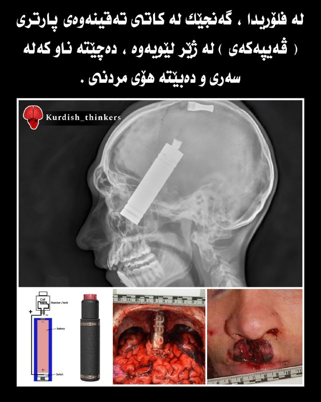 تا ئێستا بە هۆی تەقینەوەی پاتری …