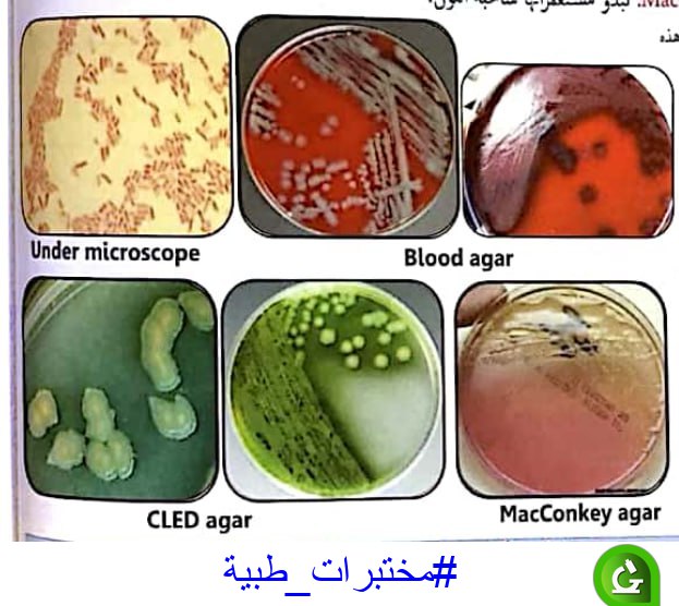 [#مختبرات\_طبية](?q=%23%D9%85%D8%AE%D8%AA%D8%A8%D8%B1%D8%A7%D8%AA_%D8%B7%D8%A8%D9%8A%D8%A9)