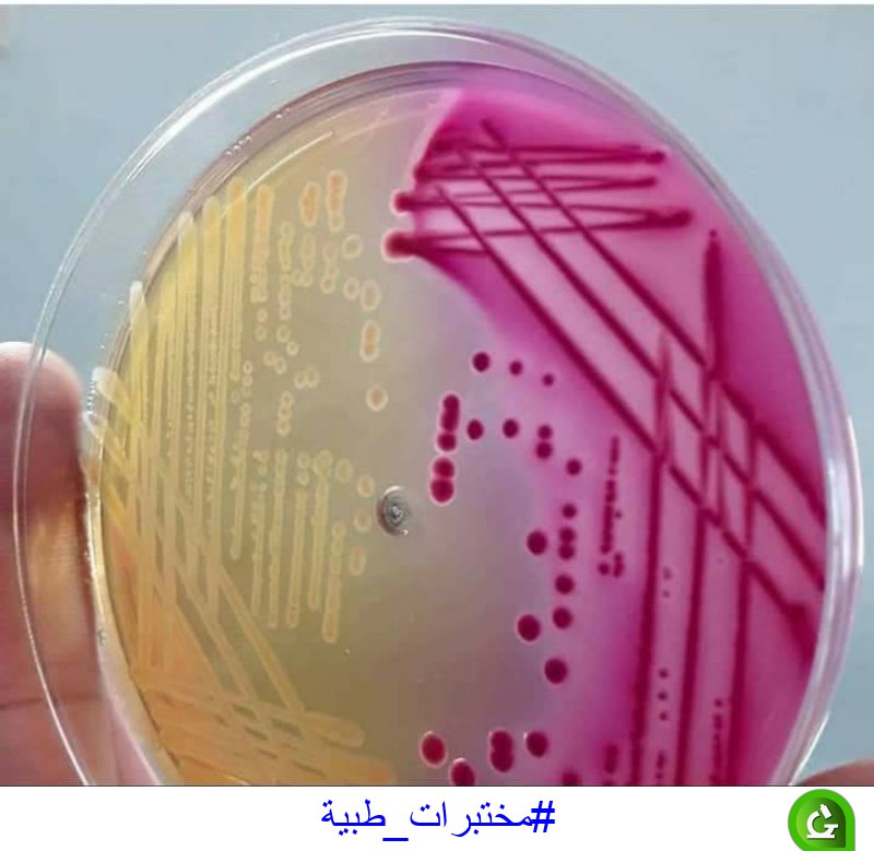 ***🧫***MacConky Agar ***🧪***