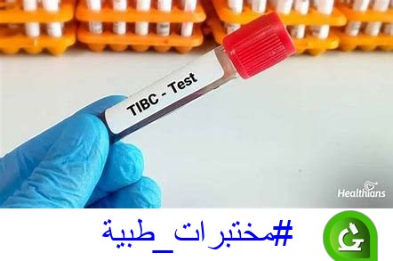 ***🔬***اختبار السعة الكلية لربط الحديد (TIBC)