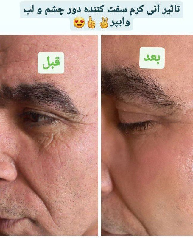 نتیجه استفاده از کرم سفت کننده …