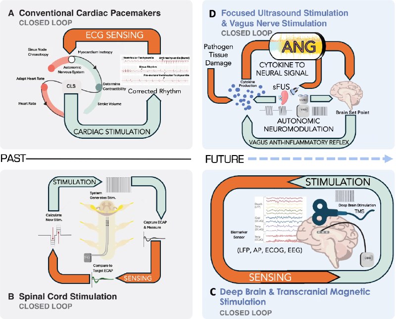 Новая [статья](https://bioelecmed.biomedcentral.com/articles/10.1186/s42234-024-00163-4) про **передовые разработки для …